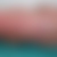 Contagious impetigo, large-bubble (bullous  impetigo)

