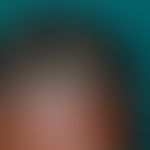 Impetigo contagiosa, small vesicles: Pronounced impetigo in a 14-year-old Ethiopian girl, no pret...
