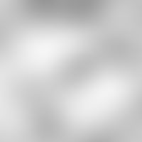 Capillary microscopy Electron microscopy: Small subepidermal capillary with a significantly dilat...