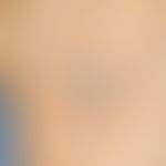 Squamous cell carcinoma of the skin: sharply defined, on the base well movable, centrally crusty ...