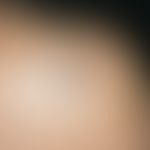 Keloid:&nbsp;chronisch stationäres Krankheitsbild; im Bereich einer Tätowierung aufgetretene, dem...