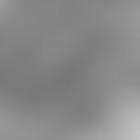 Keratinocyte. electron microscopy: detailed enlargement of a keratinocyte from Str. granulosum; t...