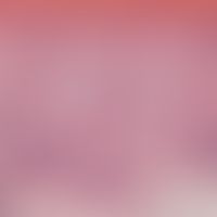 Keratosis actinica (Detailvergrößerung): Hypertrophe aktinische Keratose. Aufhebung der epidermal...
