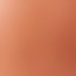Keratosis actinica. Auflichtmikroskopie: Pigmentierte aktinische Keratose (Wangenregion). Interfo...