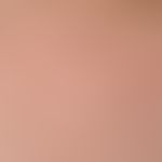 Keratosis follicularis: Inflammatory, follicularly bound papules in the area of the neck of a 37-...