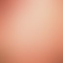 Keratosis follicularis akneiformis, Typ Siemens. Disseminierte, follikuläre Hyperkeratosen der Jo...