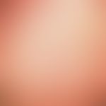 Keratosis follicularis akneiformis, type Siemens. Disseminated, follicular hyperkeratosis of the ...