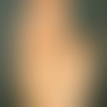 Keratosis palmoplantaris diffusa circumscripta, congenital, massive, evenly distributed, waxy cor...