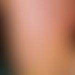 Keratosis palmoplantaris papulosa seu maculosa. since childhood persistent, chronically stationar...