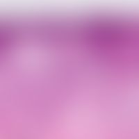 Dermatitis herpetiformis,&nbsp;Orthokeratose. In der oberen und mittleren Dermis zeigt sich ein t...