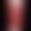 Dermatitis, phototoxic. about 48 hours old, distally (by socks) sharply bordered, severely itchin...
