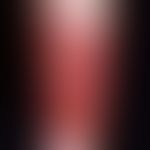 Dermatitis, phototoxische. Etwa 48 Stunden alte, nach distal (durch Socken) scharf begrenzte, hef...