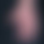 Dermatomyositis (V-Zeichen): Charakteristische, die Diagnose "Kollagenose" nahezu beweisende, kut...