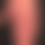 Dermatomyositis (Übersicht):&nbsp; Flächenafte, angedeutet streifes Erythem mit rötlich-lividen P...