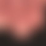 Dermatomyositis: Flächige rote Plaques an den Endphalange. Hyperkeratotische Nagelfalze
