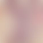 Dilated pore. Zystische Erweiterung des Infundibulums, bei deutlicher Akanthose des Follikelepith...