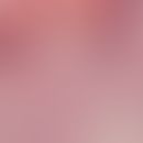 Dyskeratose. Links im Bild an der Epitheloberfläche sind dyskeratotische Zellen (Corps ronds) erk...