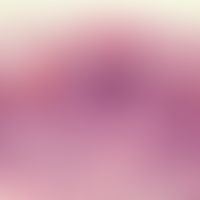 Dyskeratosis follicularis. Hyperplastische Epidermis mit dyskeratotischen Zellen sowie akantholyt...