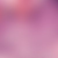 Dyskeratosis follicularis. Ausschnittsvergrößerung: Akantholytische Spaltbildung sowie deutlich n...