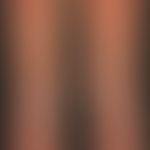 Dyskeratosis follicularis. Übersichtsaufnahme: Multiple, chronisch dynamische, intertriginös loka...