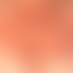 Dyskeratosis follicularis (Morbus Darier):&nbsp;Akute Provokation der Erkrankung nach leichter De...