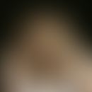 dysplasia, ectodermal. since earliest childhood sparse hair growth in a 4-year-old boy. already s...