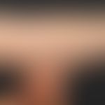 Ehlers Danlos Syndrom: Hyperelastizität der Haut
