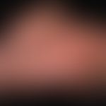 Dyshidrotische Dermatitis:&nbsp;Beide Handflächen betreffende, chronisch rezidivierende, teils ve...