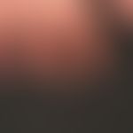 Thrombangiitis obliterans. 32-year-old patient with a nicotine abuse lasting for years and a patc...