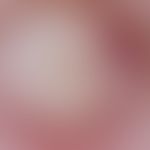 Epidermalzyste: Auflichtmikroskopie: Scharf begrenzter, verschieblicher, runder Knoten. Am untere...