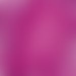 Epidermalzyste, proliferierende. Detailvergrößerung der linken Zystenwand. Hier invasives und des...