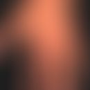 Epidermodysplasia verruciformis: disseminierte und generalisierte Aussaat von Warzen; hier Aussch...