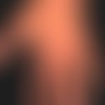 Epidermodysplasia verruciformis: disseminierte und generalisierte Aussaat von Warzen; hier Aussch...