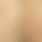Epidermolysis bullosa junctionalis, non-Herlitz. Flächige Erytheme und Erosionen neben großen Bla...