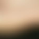 Epidermolysis bullosa simplex lokalisiert, Weber-Cockayne. Akute, nach leichtem Fußmarsch im Bere...