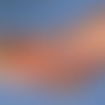 Erysipelas. hemorrhagic blistering and erosions on sharply defined erythema in the area of the fo...
