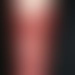 erysipelas. solitary, acutely occurring, extensive, sharply defined, red plaque and bulging blist...