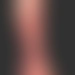 erysipelas.extensive, sharply defined, painful redness and plaque formation in the area of the lo...
