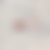 Erysipelas melanomatosum Melanommetastasis in a cutaneous lymph vessel (antibodies against S100 p...