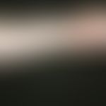 Erysipeloid. Multiple, chronisch dynamische, asymmetrische, disseminierte, 3,0-6,0 cm große, rund...