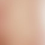 Erythema anulare centrifugum. 53 Jahre alter Patient mit Hautveränderungen seit mehreren Monaten....