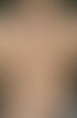 Erythema dyschromicum perstans. 54 Jahre alter Mann. Seit vielen Monaten bestehende, flächenhafte...