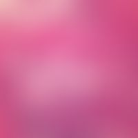 Erythema induratum. Spätstadium der Entzündung; lobuläres Bindegewebe stellenweise komplett durch...