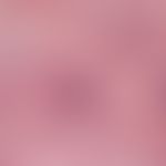 Erythema nodosum. Vollstadium des Erythema nodosum. Granulomatöse septale Pannikulitis mit lympho...
