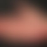 Erythema palmare et plantare symptomaticum. Übersichtsaufnahme: Unscharf begrenzte, flächige Rötu...