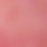 Erythema perstans faciei. Auflichtmikroskopie: Wangenregion einer 20-jährigen Frau. Gleichförmig ...