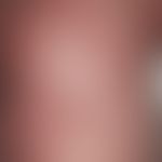 Erythrodermie. Universelle, chronisch stationäre, seit 3 Monaten konstante Hautrötung mit lederar...