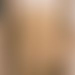 Erythrokeratodermia progressiva symmetrica. extensive, sharply defined, brown-yellow discoloured,...