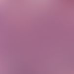 Erythroplasia. detail enlargement: infiltrating, strictly intraepithelial carcinoma. monomorphic,...