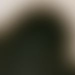 Melanom, malignes, superfiziell spreitendes. Auflichtmikroskopie: Radiäres Streaming.
